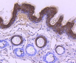Cytokeratin 10 Recombinant Rabbit Monoclonal Antibody (ST05-43), Invitrogen&trade;