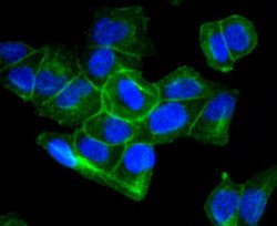 Invitrogen Sodium Potassium ATPase Recombinant Rabbit Monoclonal Antibody (ST0533) 100 &mu;L | Buy Online | Invitrogen&trade; | Fisher Scientific