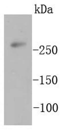 Invitrogen Acetyl-CoA Carboxylase Recombinant Rabbit Monoclonal Antibody (ST53-08) 100 &mu;L | Buy Online | Invitrogen&trade; | Fisher Scientific