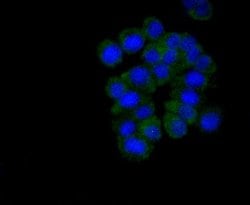 Invitrogen Musashi-2 Recombinant Rabbit Monoclonal Antibody (ST59-02) 100