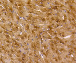 Invitrogen Musashi-2 Recombinant Rabbit Monoclonal Antibody (ST59-02) 100