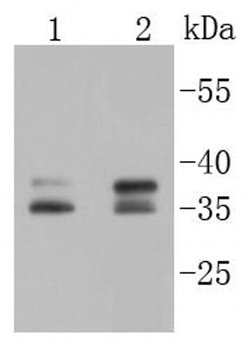 Invitrogen Musashi-2 Recombinant Rabbit Monoclonal Antibody (ST59-02) 100