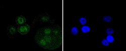 Invitrogen p73 Recombinant Rabbit Monoclonal Antibody (ST05-76) 100 &mu;L;