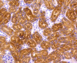 Invitrogen p73 Recombinant Rabbit Monoclonal Antibody (ST05-76) 100 &mu;L;