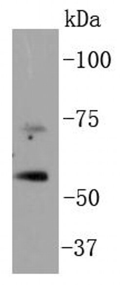 Invitrogen p73 Recombinant Rabbit Monoclonal Antibody (ST05-76) 100 &mu;L;