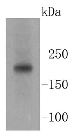 Invitrogen TSC2 Recombinant Rabbit Monoclonal Antibody (SC05-59) 100 &mu;L;