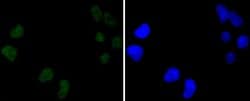 Invitrogen DNA-PK Recombinant Rabbit Monoclonal Antibody (SC57-08) 100