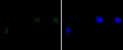 Invitrogen DNA-PK Recombinant Rabbit Monoclonal Antibody (SC57-08) 100