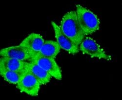 Invitrogen Cytokeratin 16 Recombinant Rabbit Monoclonal Antibody (SC52-09)