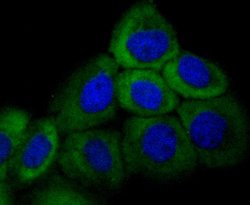Invitrogen Cytokeratin 16 Recombinant Rabbit Monoclonal Antibody (SC52-09)