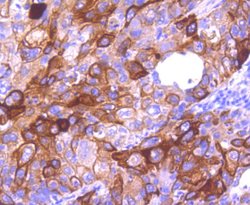 Invitrogen Cytokeratin 16 Recombinant Rabbit Monoclonal Antibody (SC52-09)