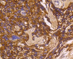 Invitrogen Cytokeratin 16 Recombinant Rabbit Monoclonal Antibody (SC52-09)