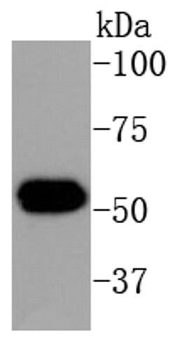 Invitrogen Cytokeratin 16 Recombinant Rabbit Monoclonal Antibody (SC52-09)