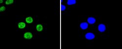Invitrogen UBC9 Recombinant Rabbit Monoclonal Antibody (SC0534) 100 &mu;L;