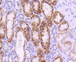 Invitrogen UBC9 Recombinant Rabbit Monoclonal Antibody (SC0534) 100 &mu;L;