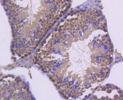 Invitrogen UBC9 Recombinant Rabbit Monoclonal Antibody (SC0534) 100 &mu;L;