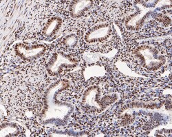 Invitrogen Phospho-ATF2 (Thr71) Recombinant Rabbit Monoclonal Antibody