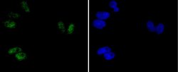 Invitrogen Phospho-ATF2 (Thr71) Recombinant Rabbit Monoclonal Antibody