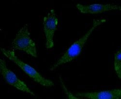 Invitrogen Phospho-TrkB (Tyr817) Recombinant Rabbit Monoclonal Antibody (SC0556) 100 &mu;L | Buy Online | Invitrogen&trade; | Fisher Scientific
