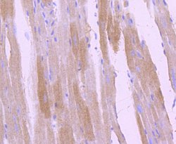 Invitrogen Phospho-TrkB (Tyr817) Recombinant Rabbit Monoclonal Antibody (SC0556) 100 &mu;L | Buy Online | Invitrogen&trade; | Fisher Scientific