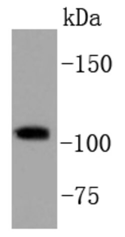 Invitrogen PIK3CB Recombinant Rabbit Monoclonal Antibody (SC0580) 100 &mu;L;