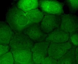 Invitrogen Phospho-EGFR (Tyr1173) Recombinant Rabbit Monoclonal Antibody