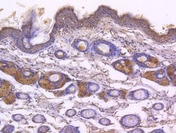 Invitrogen Phospho-EGFR (Tyr1173) Recombinant Rabbit Monoclonal Antibody