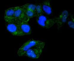 Invitrogen Radixin Recombinant Rabbit Monoclonal Antibody (SC06-22) 100