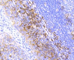 Invitrogen Radixin Recombinant Rabbit Monoclonal Antibody (SC06-22) 100