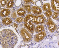 Invitrogen Radixin Recombinant Rabbit Monoclonal Antibody (SC06-22) 100