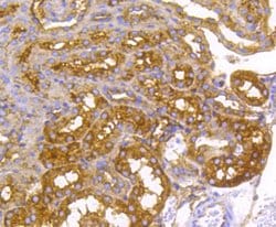 Invitrogen Radixin Recombinant Rabbit Monoclonal Antibody (SC06-22) 100