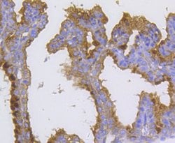 Invitrogen Radixin Recombinant Rabbit Monoclonal Antibody (SC06-22) 100