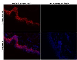 Invitrogen Cytokeratin 14 Recombinant Rabbit Monoclonal Antibody (SC65-06)