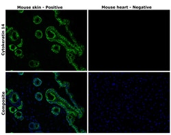 Invitrogen Cytokeratin 14 Recombinant Rabbit Monoclonal Antibody (SC65-06)