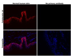 Invitrogen Cytokeratin 14 Recombinant Rabbit Monoclonal Antibody (SC65-06)