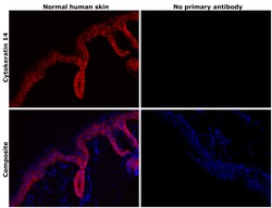Invitrogen Cytokeratin 14 Recombinant Rabbit Monoclonal Antibody (SC65-06)