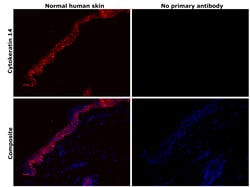Invitrogen Cytokeratin 14 Recombinant Rabbit Monoclonal Antibody (SC65-06)
