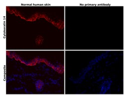 Invitrogen Cytokeratin 14 Recombinant Rabbit Monoclonal Antibody (SC65-06)