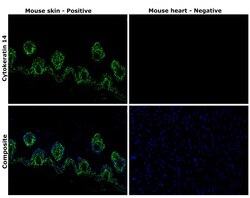Invitrogen Cytokeratin 14 Recombinant Rabbit Monoclonal Antibody (SC65-06)