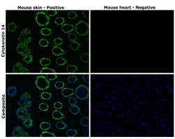 Invitrogen Cytokeratin 14 Recombinant Rabbit Monoclonal Antibody (SC65-06)