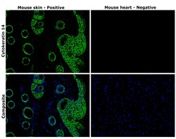 Invitrogen Cytokeratin 14 Recombinant Rabbit Monoclonal Antibody (SC65-06)