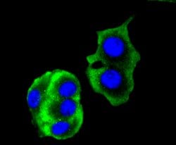 Cytokeratin 14 Recombinant Rabbit Monoclonal Antibody (SC65-06), Invitrogen
