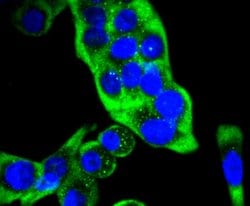 Cytokeratin 14 Recombinant Rabbit Monoclonal Antibody (SC65-06), Invitrogen