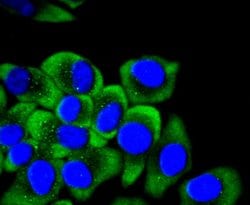 Cytokeratin 14 Recombinant Rabbit Monoclonal Antibody (SC65-06), Invitrogen