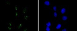 Invitrogen WT1 Recombinant Rabbit Monoclonal Antibody (SC06-41) 100 &mu;L;