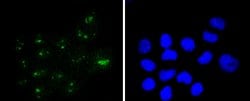 Invitrogen WT1 Recombinant Rabbit Monoclonal Antibody (SC06-41) 100 &mu;L;