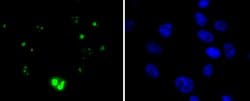 Invitrogen WT1 Recombinant Rabbit Monoclonal Antibody (SC06-41) 100 &mu;L;