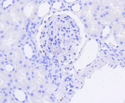 Invitrogen WT1 Recombinant Rabbit Monoclonal Antibody (SC06-41) 100 &mu;L;