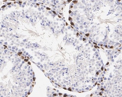 Invitrogen WT1 Recombinant Rabbit Monoclonal Antibody (SC06-41) 100 &mu;L;