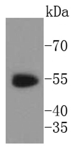 Invitrogen WT1 Recombinant Rabbit Monoclonal Antibody (SC06-41) 100 &mu;L;